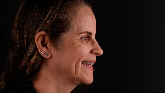 Rejuvenescimento Natural, Sem Exageros.