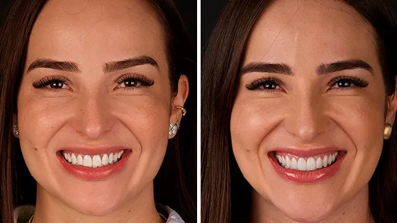 Implantes de Alta Performance e Longevidade.